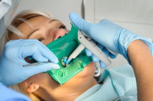 Homeodent Dentysta Łódź - Leczenie w Koferdamie - Dentysta górna, dentysta Łódź, dentysta Łódź górna, dobry dentysta Łódź górna, dobry stomatolog Łódź górna, leczenie kanałowe Łódź, leczenie kanałowe Łódź górna, protetyka Łódź, stomatolog górna, stomatolog Łódź, stomatolog Łódź górna